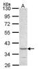 Cytohesin 1 Interacting Protein antibody, GTX106363, GeneTex, Western Blot image 