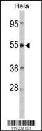 Corticotropin Releasing Hormone Receptor 2 antibody, 62-463, ProSci, Western Blot image 