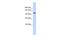 ATPase Plasma Membrane Ca2+ Transporting 4 antibody, A03386, Boster Biological Technology, Western Blot image 