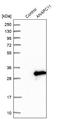 Anaphase Promoting Complex Subunit 11 antibody, NBP1-90140, Novus Biologicals, Western Blot image 