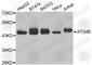 Autophagy Related 4B Cysteine Peptidase antibody, A4534, ABclonal Technology, Western Blot image 