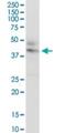 Cystinosin, Lysosomal Cystine Transporter antibody, H00001497-D01P, Novus Biologicals, Western Blot image 