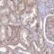 Zinc Finger CCCH-Type Containing 13 antibody, PA5-58744, Invitrogen Antibodies, Immunohistochemistry paraffin image 