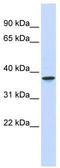 THO Complex 6 antibody, TA346641, Origene, Western Blot image 