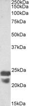 LAT2 antibody, 43-302, ProSci, Western Blot image 