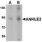 Kiaa0692 antibody, TA319845, Origene, Western Blot image 