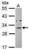 Microtubule Associated Protein RP/EB Family Member 1 antibody, PA5-28395, Invitrogen Antibodies, Western Blot image 
