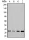 STIP1 Homology And U-Box Containing Protein 1 antibody, abx142251, Abbexa, Western Blot image 