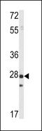 Protein tyrosine phosphatase type IVA 1 antibody, LS-C101021, Lifespan Biosciences, Western Blot image 