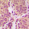 Phosphoinositide-3-Kinase Regulatory Subunit 1 antibody, LS-C354051, Lifespan Biosciences, Immunohistochemistry paraffin image 