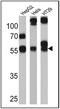 Cytochrome P450 Family 3 Subfamily A Member 7 antibody, NB100-74402, Novus Biologicals, Western Blot image 