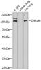Zinc Finger Protein 148 antibody, 22-622, ProSci, Western Blot image 