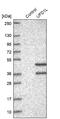 Ubiquitin Recognition Factor In ER Associated Degradation 1 antibody, NBP1-86879, Novus Biologicals, Western Blot image 