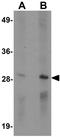 Natural killer cell receptor 2B4 antibody, GTX17115, GeneTex, Western Blot image 