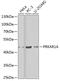 cAMP-dependent protein kinase type I-alpha regulatory subunit antibody, GTX32809, GeneTex, Western Blot image 