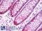 T Cell Lymphoma Invasion And Metastasis 1 antibody, LS-B9626, Lifespan Biosciences, Immunohistochemistry frozen image 