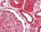 Fas Associated Via Death Domain antibody, A00237, Boster Biological Technology, Immunohistochemistry paraffin image 