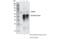 YTH N6-Methyladenosine RNA Binding Protein 1 antibody, 86463S, Cell Signaling Technology, Immunoprecipitation image 