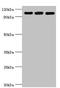 Elongation Factor Tu GTP Binding Domain Containing 2 antibody, LS-C675694, Lifespan Biosciences, Western Blot image 