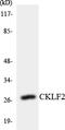 CKLF Like MARVEL Transmembrane Domain Containing 2 antibody, LS-C291803, Lifespan Biosciences, Western Blot image 