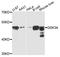 Glycogen Synthase Kinase 3 Alpha antibody, LS-B14374, Lifespan Biosciences, Western Blot image 