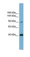 Unc-5 Netrin Receptor C antibody, orb330416, Biorbyt, Western Blot image 
