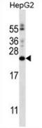 Phosphatidylinositol Glycan Anchor Biosynthesis Class H antibody, AP53296PU-N, Origene, Western Blot image 