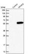 MAP kinase-interacting serine/threonine-protein kinase 2 antibody, NBP1-92129, Novus Biologicals, Western Blot image 