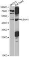 N-Acylsphingosine Amidohydrolase 1 antibody, LS-C748963, Lifespan Biosciences, Western Blot image 