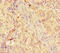 Matrix Metallopeptidase 12 antibody, LS-C317639, Lifespan Biosciences, Immunohistochemistry paraffin image 