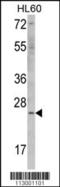 ES Cell Expressed Ras antibody, TA324562, Origene, Western Blot image 
