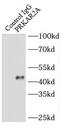 Protein Kinase CAMP-Dependent Type II Regulatory Subunit Alpha antibody, FNab06781, FineTest, Immunoprecipitation image 