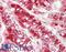 Galactosidase Alpha antibody, LS-B14601, Lifespan Biosciences, Immunohistochemistry paraffin image 