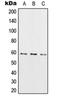 RIO Kinase 3 antibody, orb214828, Biorbyt, Western Blot image 