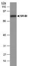 Scavenger Receptor Class B Member 1 antibody, PA1-31393, Invitrogen Antibodies, Western Blot image 