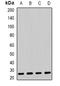 Adenylate Kinase 4 antibody, LS-C482345, Lifespan Biosciences, Western Blot image 