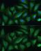 Protein Tyrosine Phosphatase Non-Receptor Type 22 antibody, GTX66229, GeneTex, Immunofluorescence image 