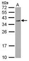 Regulation Of Nuclear Pre-MRNA Domain Containing 1A antibody, LS-C155458, Lifespan Biosciences, Western Blot image 