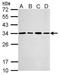 Proteasome Activator Subunit 3 antibody, NBP1-33498, Novus Biologicals, Western Blot image 