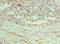 Peroxiredoxin 1 antibody, LS-C376404, Lifespan Biosciences, Immunohistochemistry paraffin image 