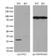 Nitrilase Family Member 2 antibody, GTX84036, GeneTex, Western Blot image 