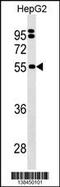 O-phosphoseryl-tRNA(Sec) selenium transferase antibody, 59-861, ProSci, Western Blot image 