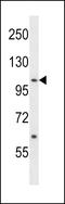 Activated CDC42 kinase 1 antibody, LS-C155930, Lifespan Biosciences, Western Blot image 