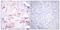 Death Domain Associated Protein antibody, PA5-38111, Invitrogen Antibodies, Immunohistochemistry paraffin image 