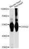 Calsequestrin 2 antibody, LS-C749238, Lifespan Biosciences, Western Blot image 