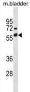Keratin 6A antibody, abx031155, Abbexa, Western Blot image 