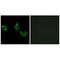 EFEMP2 antibody, A05653, Boster Biological Technology, Immunohistochemistry paraffin image 