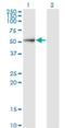 Proteasome 26S Subunit, Non-ATPase 5 antibody, H00005711-M17, Novus Biologicals, Western Blot image 