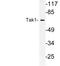 Mitogen-Activated Protein Kinase Kinase Kinase 7 antibody, LS-C177778, Lifespan Biosciences, Western Blot image 