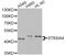 CMP-N-acetylneuraminate-poly-alpha-2,8-sialyltransferase antibody, A6754, ABclonal Technology, Western Blot image 